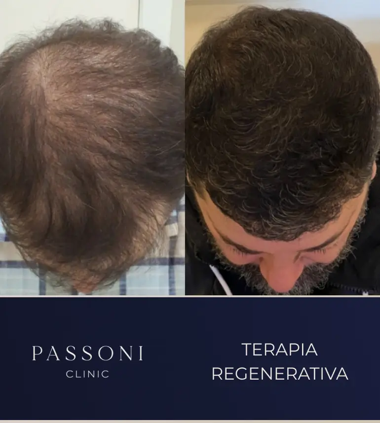 Passoni _ antes e depois 06